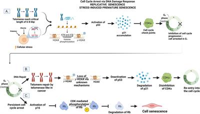 Cerebral Microvascular Senescence and Inflammation in Diabetes